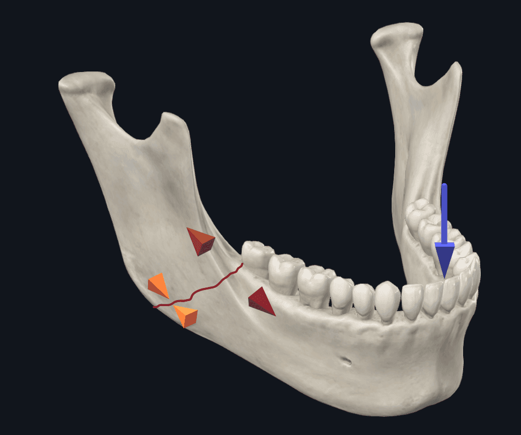 0414Figure5a